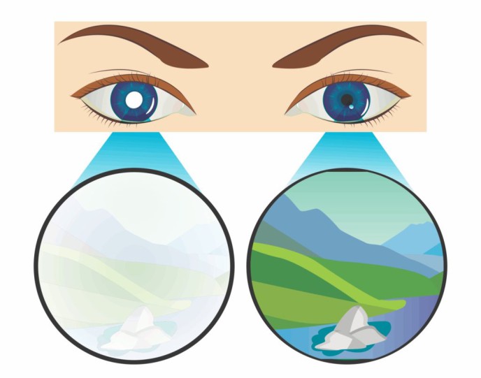 benh-nhuoc-thi-o-nguoi-lon-co-nguy-hiem-khong-chua-nhu-the-nao