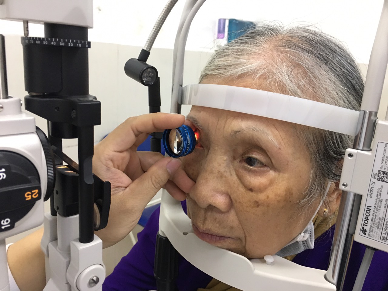 dieu-can-biet-ve-benh-duc-thuy-tinh-the