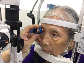 lao-thi-la-gi-nguyen-nhan-va-cach-dieu-tri