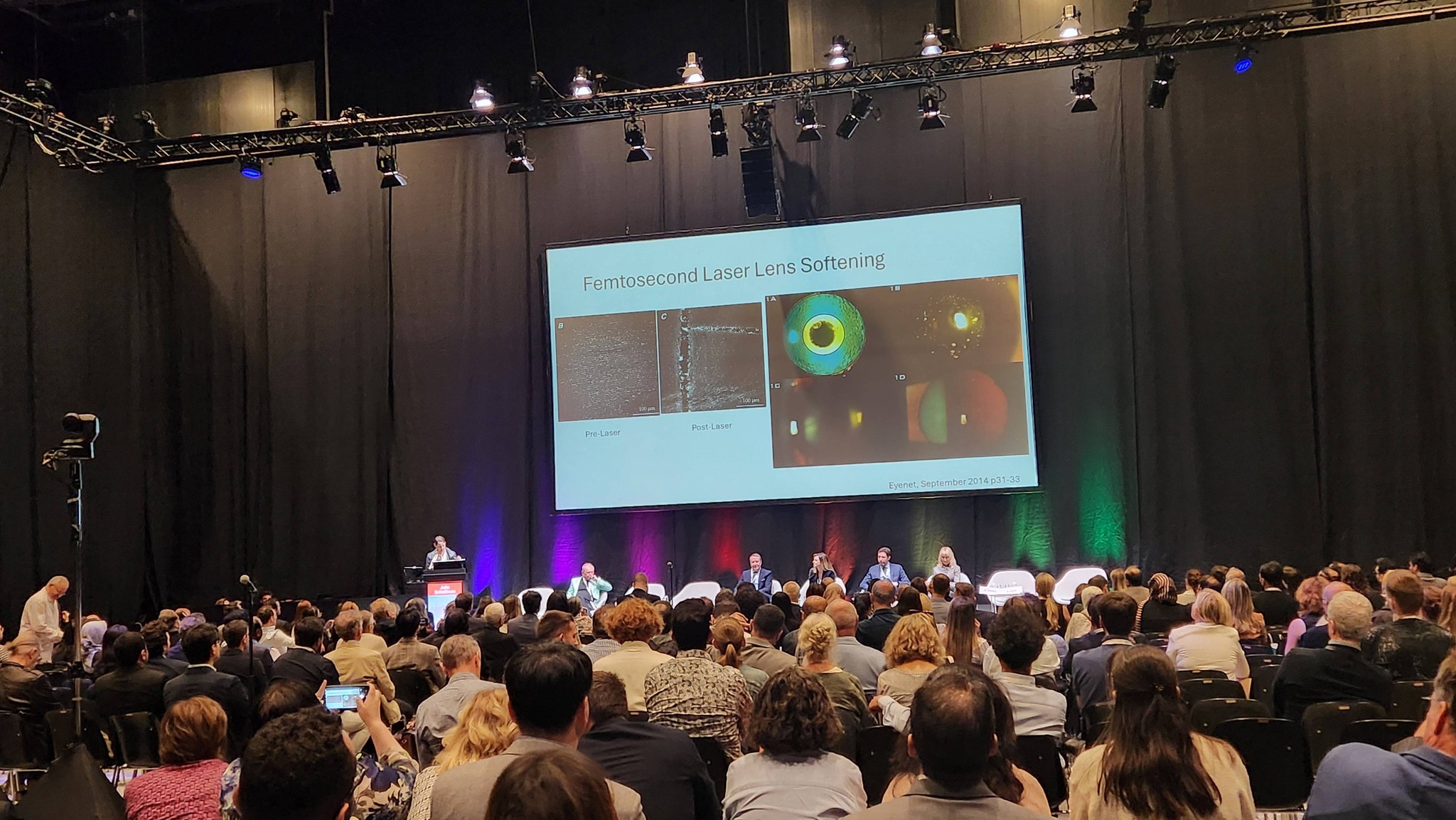 escrs-2025-ky-niem-30-nam-femtosecond-laser-trong-phau-thuat-khuc-xa